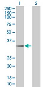 STC2 Antibody in Western Blot (WB)