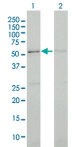 CDC2L5 Antibody in Western Blot (WB)