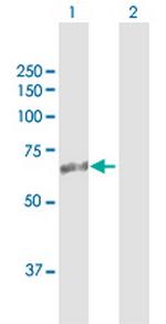 ASMTL Antibody in Western Blot (WB)