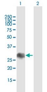 SOCS1 Antibody in Western Blot (WB)