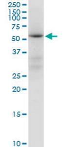 ALDH4A1 Antibody in Western Blot (WB)