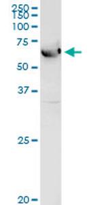 ALDH4A1 Antibody in Western Blot (WB)