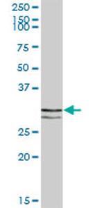 STX11 Antibody in Western Blot (WB)