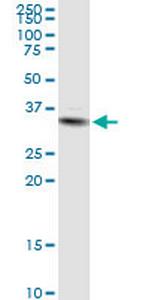 STX11 Antibody in Western Blot (WB)