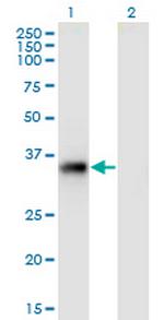 STX11 Antibody in Western Blot (WB)