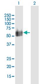 HYAL2 Antibody in Western Blot (WB)