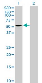 B4GALT3 Antibody in Western Blot (WB)