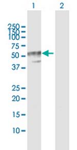 B4GALT3 Antibody in Western Blot (WB)