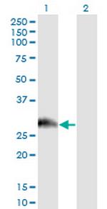 PAGE1 Antibody in Western Blot (WB)