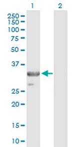 TRADD Antibody in Western Blot (WB)