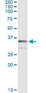 TRADD Antibody in Immunoprecipitation (IP)