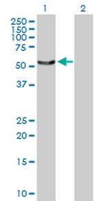 SNX4 Antibody in Western Blot (WB)