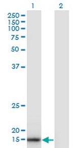 SNX3 Antibody in Western Blot (WB)