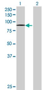 ADAM15 Antibody in Western Blot (WB)