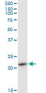 RAB11A Antibody in Western Blot (WB)