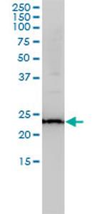 RAB11A Antibody in Western Blot (WB)