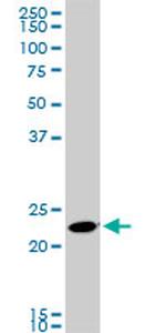 RAB11A Antibody in Western Blot (WB)