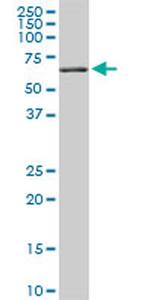 RIPK2 Antibody in Western Blot (WB)