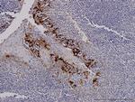 TNFRSF6B Antibody in Immunohistochemistry (Paraffin) (IHC (P))