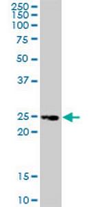 TNFRSF18 Antibody in Western Blot (WB)