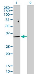 FBP2 Antibody in Western Blot (WB)