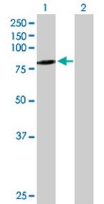 SCEL Antibody in Western Blot (WB)