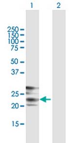 CREG1 Antibody in Western Blot (WB)