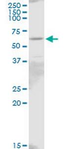 IL18R1 Antibody in Western Blot (WB)