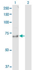 IL18R1 Antibody in Western Blot (WB)