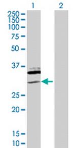 SAP30 Antibody in Western Blot (WB)