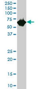 CES2 Antibody in Western Blot (WB)