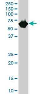 CES2 Antibody in Western Blot (WB)