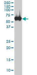 CES2 Antibody in Western Blot (WB)