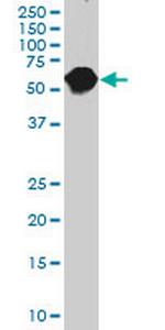 CES2 Antibody in Western Blot (WB)