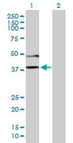 CD84 Antibody in Western Blot (WB)