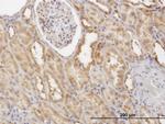 CFLAR Antibody in Immunohistochemistry (Paraffin) (IHC (P))