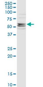 CFLAR Antibody in Western Blot (WB)