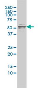 CFLAR Antibody in Western Blot (WB)