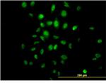 HDAC3 Antibody in Immunocytochemistry (ICC/IF)