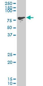 PCAF Antibody in Western Blot (WB)