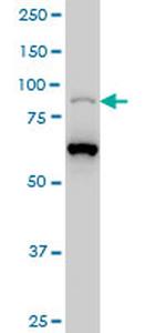 PCAF Antibody in Western Blot (WB)