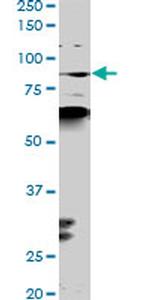 PCAF Antibody in Western Blot (WB)