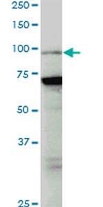 PCAF Antibody in Western Blot (WB)