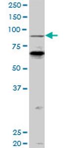 PCAF Antibody in Western Blot (WB)