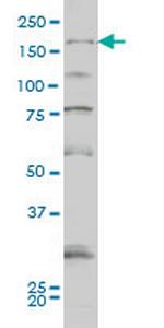 SYNJ1 Antibody in Western Blot (WB)