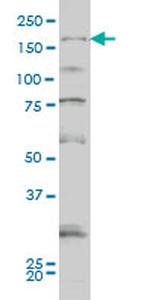 SYNJ1 Antibody in Western Blot (WB)