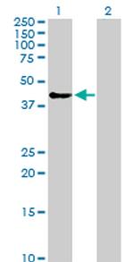 SPHK1 Antibody in Western Blot (WB)