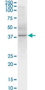 SPHK1 Antibody in Western Blot (WB)