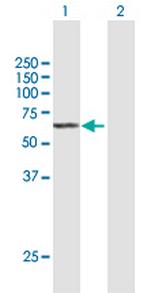 SGPL1 Antibody in Western Blot (WB)