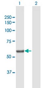 SGPL1 Antibody in Western Blot (WB)